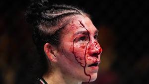 El escalofriante corte de Aldama en Noche UFC
